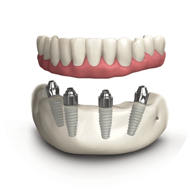 allon 4 3d model