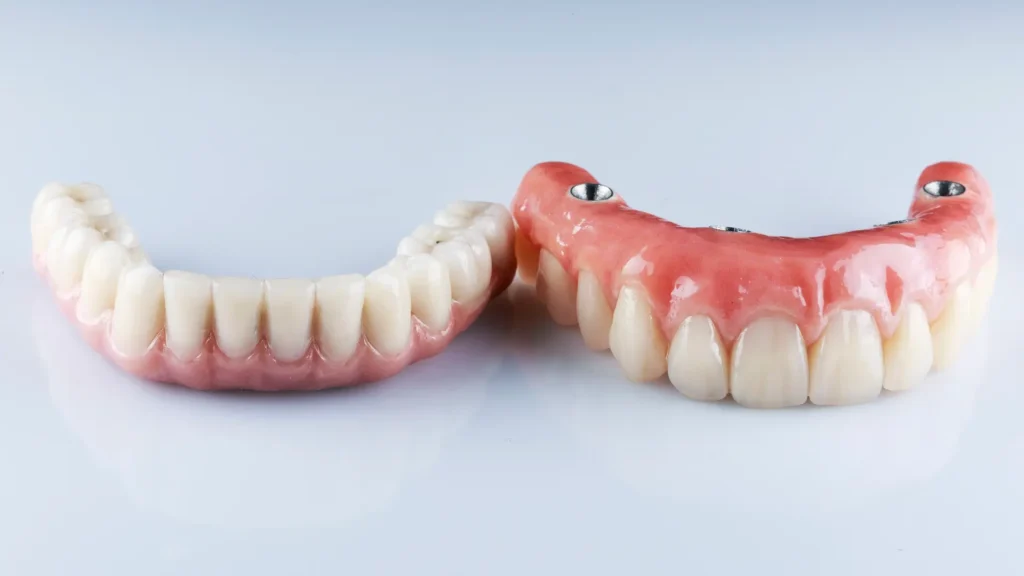 hybrid dentures