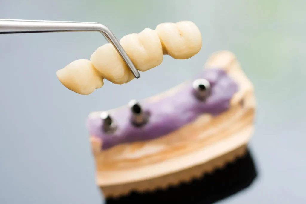 Best Decision For Your Oral Health