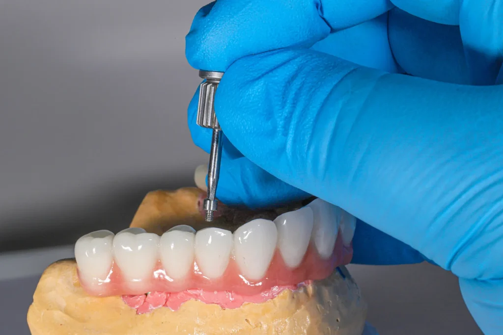 what is a bone graft for dental implant